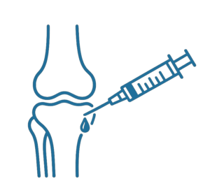 Arthrosetherapie / Hyaluronsäureapplikation